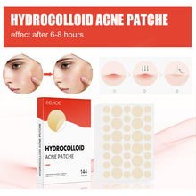 Load image into Gallery viewer, Hydrocolloid Acne Patch Waterproof Breathable Invisible Acne Patch Pimple Remover Patch Skin Care Repair