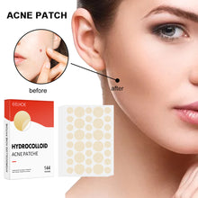 Load image into Gallery viewer, Hydrocolloid Acne Patch Waterproof Breathable Invisible Acne Patch Pimple Remover Patch Skin Care Repair