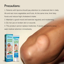 Load image into Gallery viewer, Lipoma Cream Reduce Inflammation Remove Lipomas Fibromas Subcutaneous Masses Body Care Cream Health Care