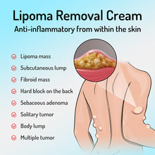 Load image into Gallery viewer, Lipoma Cream Reduce Inflammation Remove Lipomas Fibromas Subcutaneous Masses Body Care Cream Health Care