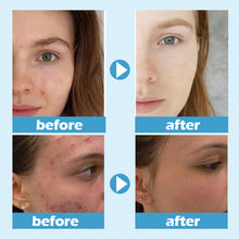 Load image into Gallery viewer, Moisturizing Sleep Facial Mask Deep Hydrating Nourishing Non-sticky Smear Facial Mask Cooling Effect Skin Care
