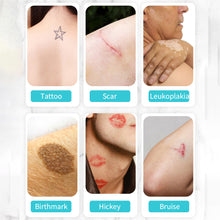 Load image into Gallery viewer, 1pc Ultra Thin Patch Tattoo Scar Flaw Concealing Tapes Tattoo Acne Cover Up Compression Scar Invisible Tattoo Cover Patches
