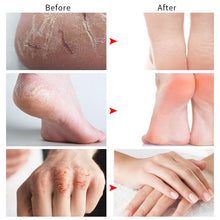 Load image into Gallery viewer, Horse Oil Moisturizing Skin Care Cream Autumn and Winter Nourishing Moisturizing Cream Repairing Dry Cracks Moisturizing Face Cream
