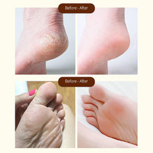 Load image into Gallery viewer, Horse Oil Foot Air Cream Foot Care Autumn and Winter Dry Feet Moisturizing Horse Oil Foot Protection Cream Foot Clearing Cream
