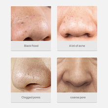 Load image into Gallery viewer, Blackhead Remover Nose Masks Acne Treatment Peeling Black Face Mask Pore Strip Black Head Peel Skin Care
