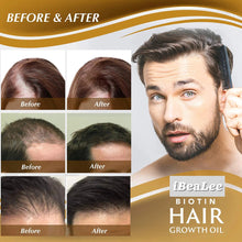 Load image into Gallery viewer, Fast Hair Growth Oil Hair Regrowth Serum Hair Thinning Treatment Hair Growth Liquid Anti-Hair Loss for Women and Men
