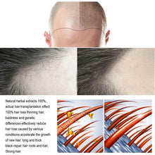 Load image into Gallery viewer, Fast Hair Growth Oil Hair Regrowth Serum Hair Thinning Treatment Hair Growth Liquid Anti-Hair Loss for Women and Men
