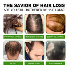 Load image into Gallery viewer, Fast Hair Growth Oil Hair Regrowth Serum Hair Thinning Treatment Hair Growth Liquid Anti-Hair Loss for Women and Men
