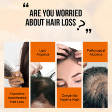 Load image into Gallery viewer, PURC Ginger Hair Growth Products Prevent Hair Loss Essential Oil Fast Growing Scalp Treatment Beauty Health for Men Women
