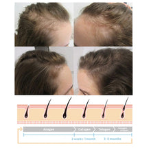 Load image into Gallery viewer, Hair Growth Spray Regrowth Ginger Spray Hair Growth Products Hair Loss Product Series Ginger Nutrient Liquid Spray
