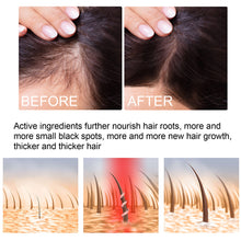 Load image into Gallery viewer, Hair Growth Spray Regrowth Ginger Spray Hair Growth Products Hair Loss Product Series Ginger Nutrient Liquid Spray
