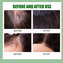 Load image into Gallery viewer, Hair Growth Spray Regrowth Ginger Spray Hair Growth Products Hair Loss Product Series Ginger Nutrient Liquid Spray
