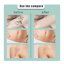 Load image into Gallery viewer, Skin Color Concealer Patch Skin Scar Tattoo Blemish Covering Patch Waterproof Sweatproof Portable Invisible Covering Patch

