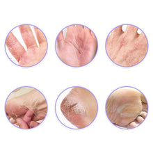 Load image into Gallery viewer, Snake Oil Moisturizing Cream Moisturizing Hand and Foot Care Neck Skin Dryness Hand Cream Body Lotion

