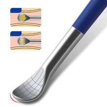 Load image into Gallery viewer, Spiral Cleaning Ear Spoon Large Chunks of Earwax 360 ° Cleaning of The External Auditory Canal Spoon Care Ear Clean Tool Earpick
