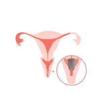 Load image into Gallery viewer, Silicone Menstrual Cup L/S Reusable Women's Hygiene Menstrual Cup Feminine Hygiene Menstrual Cup Health Care
