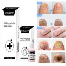 Load image into Gallery viewer, 20ml Nail Fungal Treatment Oil Feet Care Repair Essence Toe Nail Fungus Removal Gel Anti Infection Remedy Cream
