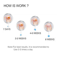 Load image into Gallery viewer, 20ml Nail Fungal Treatment Oil Feet Care Repair Essence Toe Nail Fungus Removal Gel Anti Infection Remedy Cream
