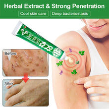 Load image into Gallery viewer, Ai Cao Skin Care Cream Skin Antibacterial Cream Portable Safe Health Care
