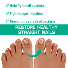 Load image into Gallery viewer, Nail Repair Fungal Relief Herbal Essence Repair Nourish &amp; Protect Grey Nail Repair Nail Fungus Ointmen
