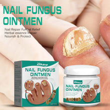 Load image into Gallery viewer, Nail Repair Fungal Relief Herbal Essence Repair Nourish &amp; Protect Grey Nail Repair Nail Fungus Ointmen
