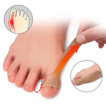 Load image into Gallery viewer, 10pcs Hand Foot Thumb Wrist Tendon Sheath Patches for Finger Protector Big Toe Orthotics Pain Relief Hallux Valgus Corrector Patch
