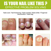 Load image into Gallery viewer, Nail Repair Gel Hand and Foot Nail Repair Soft Nail Thickening Nail Removing Nail Polish Repair Cream
