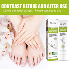 Load image into Gallery viewer, Nail Repair Gel Hand and Foot Nail Repair Soft Nail Thickening Nail Removing Nail Polish Repair Cream
