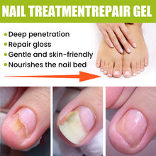 Load image into Gallery viewer, Nail Repair Gel Hand and Foot Nail Repair Soft Nail Thickening Nail Removing Nail Polish Repair Cream
