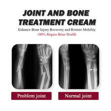 Load image into Gallery viewer, Articular Bone Collagen Cream Relieve Articular Bone Pain Correct Repair Deformation Joint Cream Health Care
