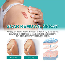 Load image into Gallery viewer, Scar Care Spray Fading Smoothing Surgical Scars Burn Scars Repairing Skin Scar Removal Spray Skin Care
