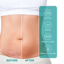 Load image into Gallery viewer, Scar Care Spray Fading Smoothing Surgical Scars Burn Scars Repairing Skin Scar Removal Spray Skin Care
