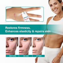 Load image into Gallery viewer, Scar Care Spray Fading Smoothing Surgical Scars Burn Scars Repairing Skin Scar Removal Spray Skin Care
