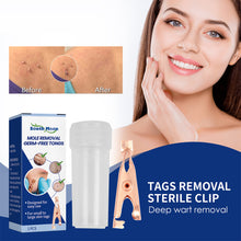 Load image into Gallery viewer, Wart Clamp Painless Warts Removal Clip Removing Warts Filamentous Warts Nevi Meatballs Skin Repair Skin Care
