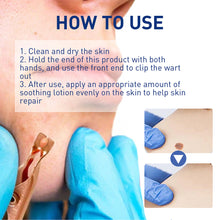 Load image into Gallery viewer, Wart Clamp Painless Warts Removal Clip Removing Warts Filamentous Warts Nevi Meatballs Skin Repair Skin Care

