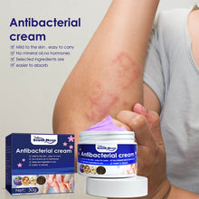 Load image into Gallery viewer, Skin Antibacterial Cream Mosquito Bite Skin Pruritus Antipruritus Cream Plant Extracts External Antibacterial Cream Skin Care
