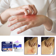 Load image into Gallery viewer, Skin Antibacterial Cream Mosquito Bite Skin Pruritus Antipruritus Cream Plant Extracts External Antibacterial Cream Skin Care
