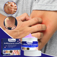 Load image into Gallery viewer, Skin Antibacterial Cream Mosquito Bite Skin Pruritus Antipruritus Cream Plant Extracts External Antibacterial Cream Skin Care

