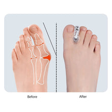 Load image into Gallery viewer, A-shaped Magnetic Toe Splitter Thumb Valgus Corrector Big Foot Bone Overlap Orthosis Clip Toe Separator Foot Care
