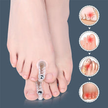 Load image into Gallery viewer, A-shaped Magnetic Toe Splitter Thumb Valgus Corrector Big Foot Bone Overlap Orthosis Clip Toe Separator Foot Care
