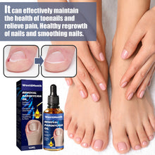 Load image into Gallery viewer, Removal Paronychia Oil Soften Toenails Relieve Swelling Pain Nail Groove Relief Oil Disinfect Repair Toenails
