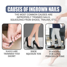 Load image into Gallery viewer, Removal Paronychia Oil Soften Toenails Relieve Swelling Pain Nail Groove Relief Oil Disinfect Repair Toenails
