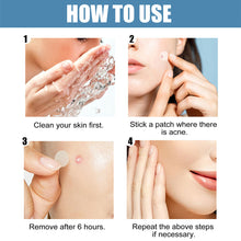 Load image into Gallery viewer, Hydrocolloid Acne Patches Waterproof Invisible Breathable Repair Acne Pimples Patches Fade Spots Acne Skin Care
