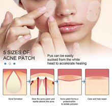Load image into Gallery viewer, Hydrocolloid Acne Patches Waterproof Invisible Breathable Repair Acne Pimples Patches Fade Spots Acne Skin Care
