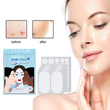 Load image into Gallery viewer, Hydrocolloid Acne Patches Waterproof Invisible Breathable Repair Acne Pimples Patches Fade Spots Acne Skin Care
