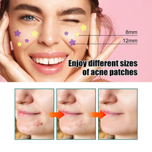 Load image into Gallery viewer, Star Shaped Acne Patches Repair Acne Fade Spots Cover Acne Marks Facial Acne Repair Patches Skin Care
