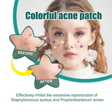 Load image into Gallery viewer, Star Shaped Acne Patches Repair Acne Fade Spots Cover Acne Marks Facial Acne Repair Patches Skin Care
