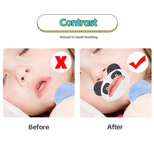 Load image into Gallery viewer, Children's Cartoon Correction Mouth Breathing Mouth Patch Sleeping Anti Opening Mouth Closing Mouth Sealing Patch Snoring Physical Breathing Patch
