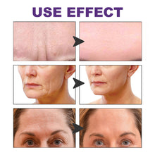 Load image into Gallery viewer, Facial Wrinkle Patches Lifting Tightening Facial Skin Improving Skin Sagging Reducing Fine Lines Facial Skin Care

