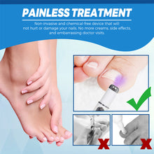 Load image into Gallery viewer, Nail Blue Light Laser Pen Onychomycosis Repair Laser Pen Restoring Nail Health Removing Odor Nail Care Tool
